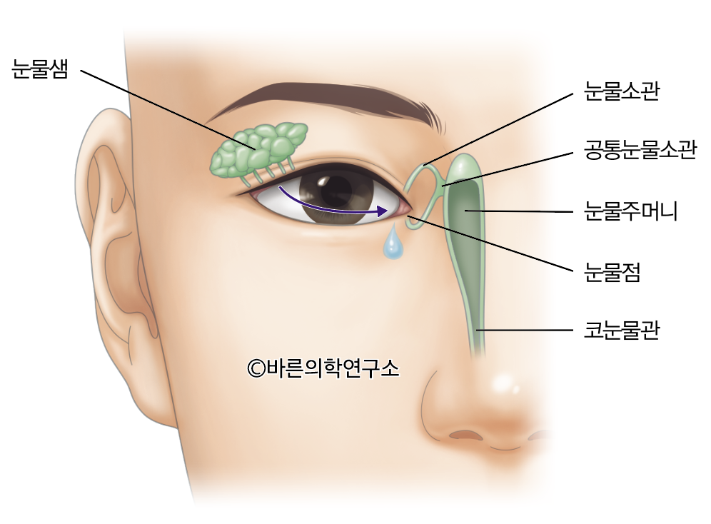 눈물배출계의 이상 - Metamedic